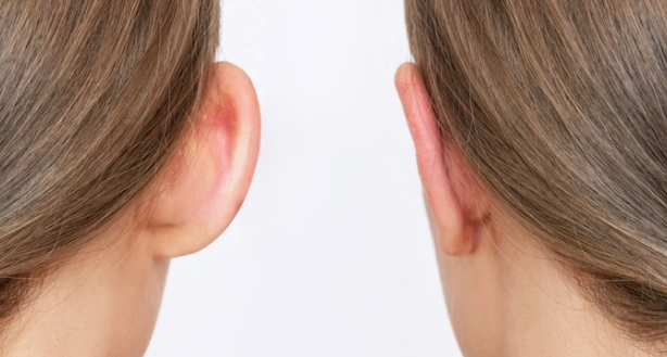 Asymétrie des oreilles